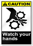 Watch Your Hands Caution Signs